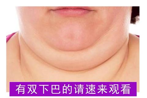 为什么会有双下巴？揭秘三大成因及科学消除妙招