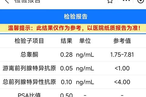 男生多久打一次算正常？科学频率解析与健康调节指南