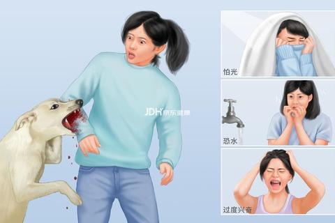 狂犬病为什么恐水？恐水症状如何缓解与科学救治要点解析