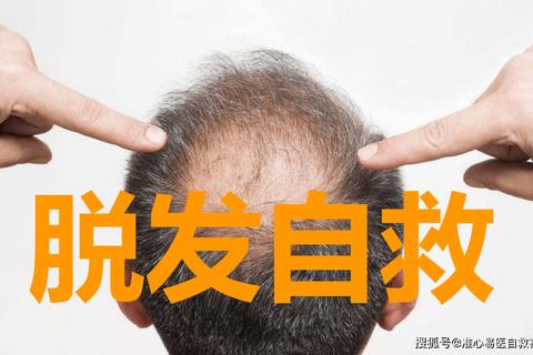 柠檬微趣怎么样用户痛点难题的解决新方案