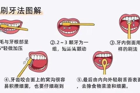 怎么正确刷牙解决牙龈出血和蛀牙困扰三步掌握正确技巧