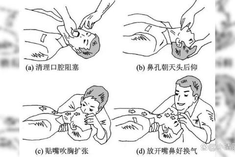 不呼吸多久会死？窒息风险急救技巧守护生命关键时刻