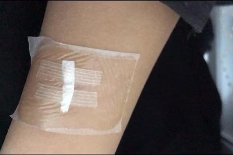 手臂手术2全流程零失误通关攻略 实战操作技巧详解