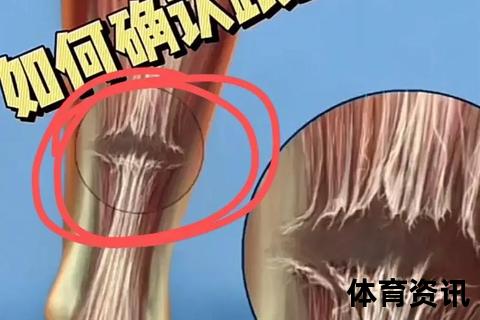 跟腱缺失之谜：人类运动进化的关键转折