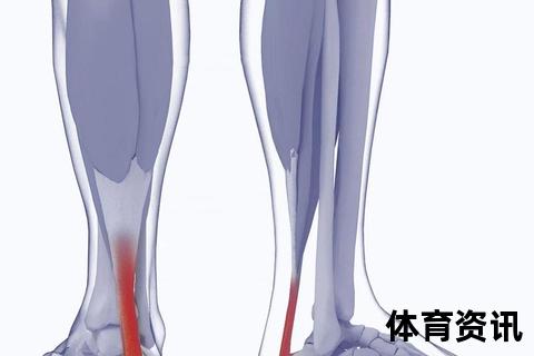 跟腱：连接小腿与足跟的核心肌腱